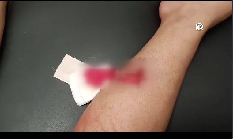 Bu tehlikeye kim dur diyecek! Sokak köpekleri sahilde yürüyen kadına saldırdı - Resim: 8